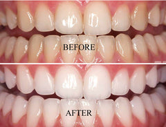 Intensive stain removal whitening toothpaste